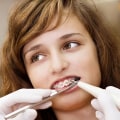 Enhancing Your Child's Smile: Visiting A Dentist For Orthodontic Braces In London