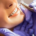The Importance Of Early Orthodontic Intervention: Choosing A Pediatric Dentist For Your Kid's Braces In Sydney