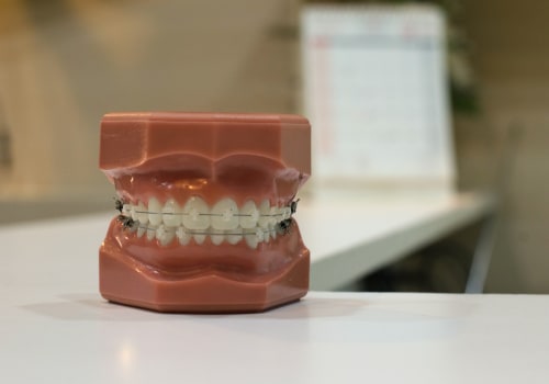 Handling Dental Emergencies: How To Secure An Appointment With A Pediatric Dentist In Monroe